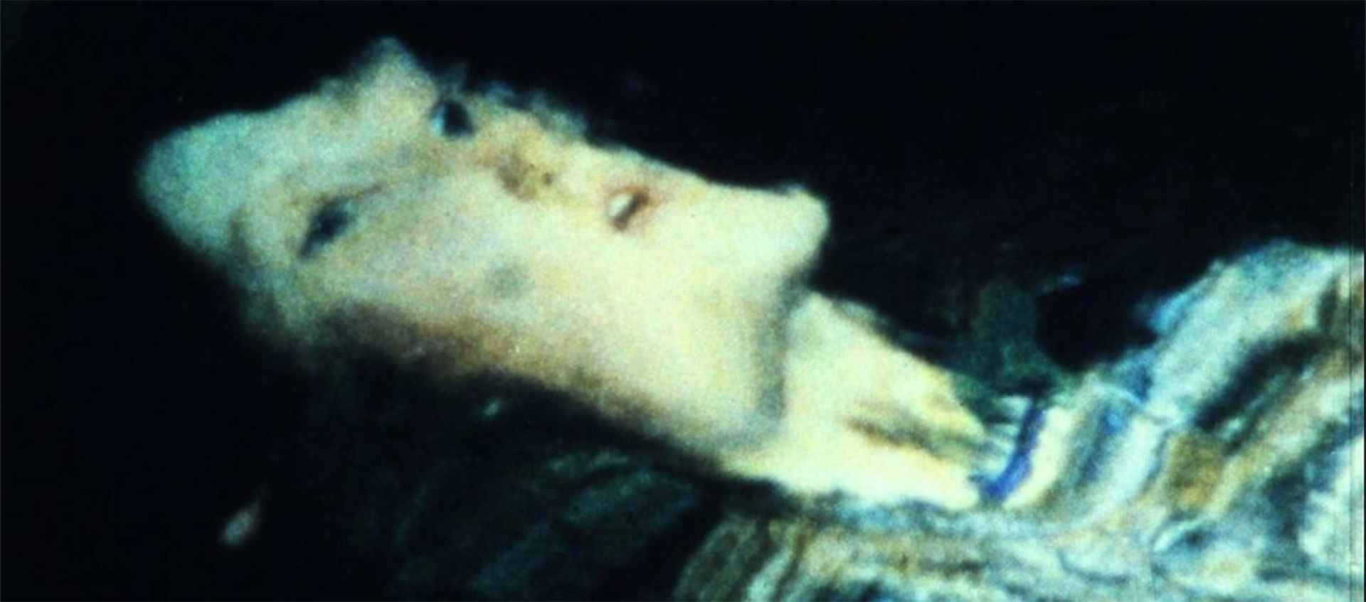A distorted image of a person lying down on a dark background. Their mouth is slightly open and their face is distorted to look almost nonhuman.